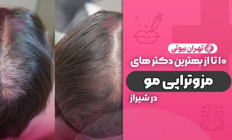 10 بهترین دکتر مزوتراپی مو در شیراز