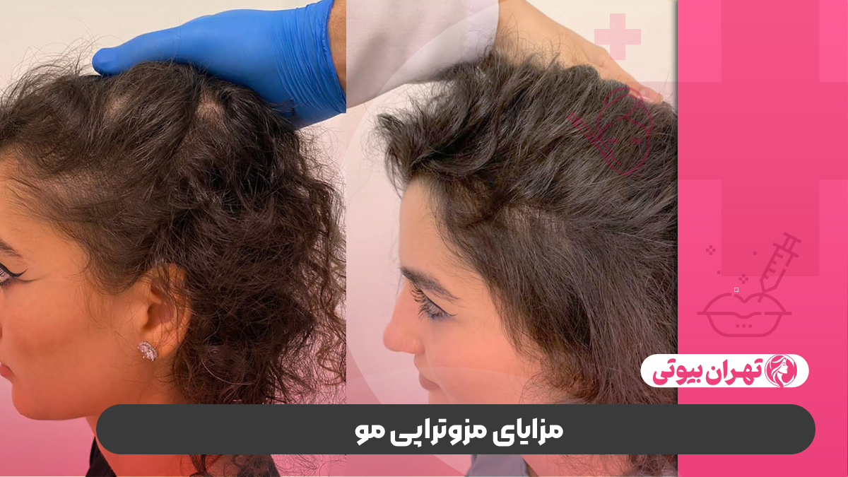 10 بهترین دکتر مزوتراپی مو در شیراز