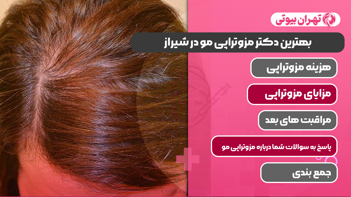 10 بهترین دکتر مزوتراپی مو در شیراز