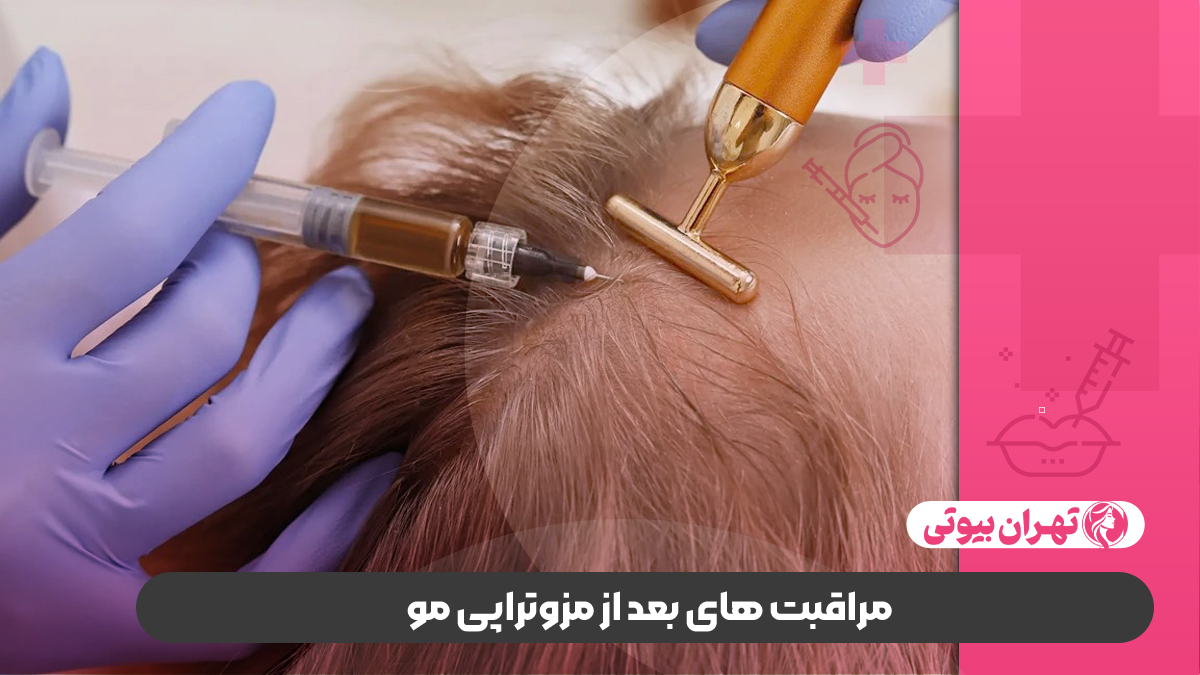 بهترین دکتر مزوتراپی مو در غرب تهران