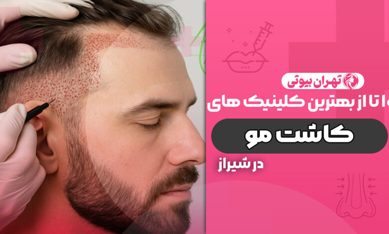 10 بهترین کلینیک کاشت مو در شیراز