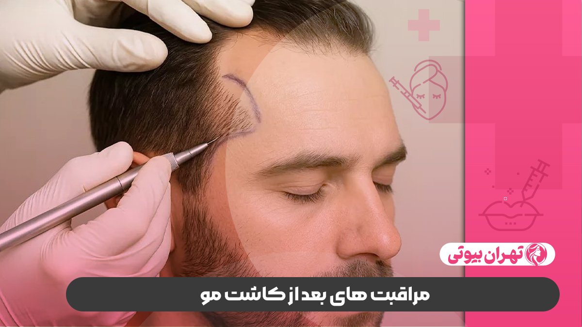 10 بهترین کلینیک کاشت مو در شیراز