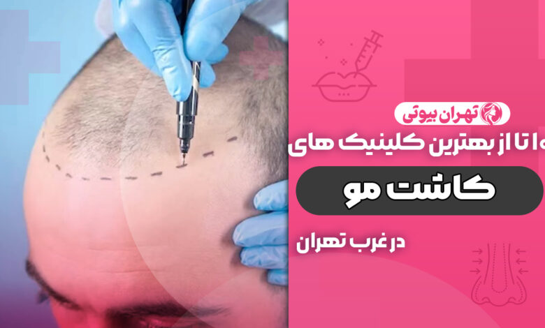 بهترین کلینیک کاشت مو در غرب تهران