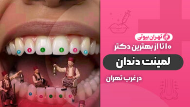 بهترین دکتر لمینت دندان در غرب تهران