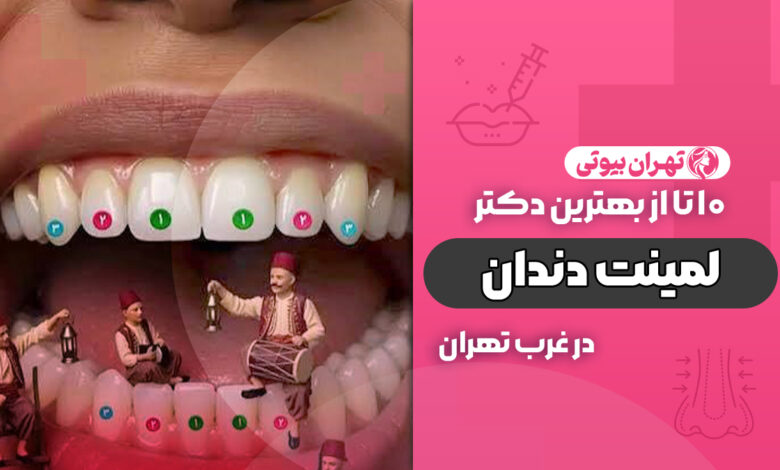 بهترین دکتر لمینت دندان در غرب تهران