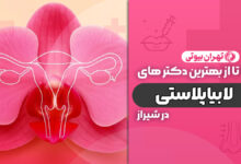 10 بهترین دکتر لابیاپلاستی در شیراز