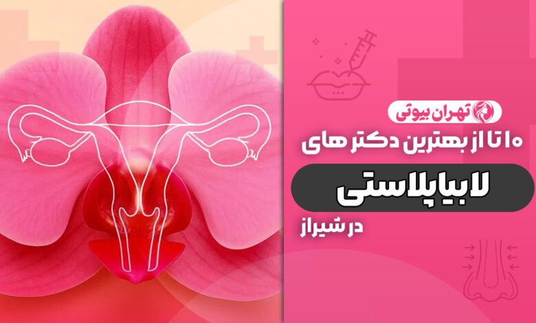 10 بهترین دکتر لابیاپلاستی در شیراز