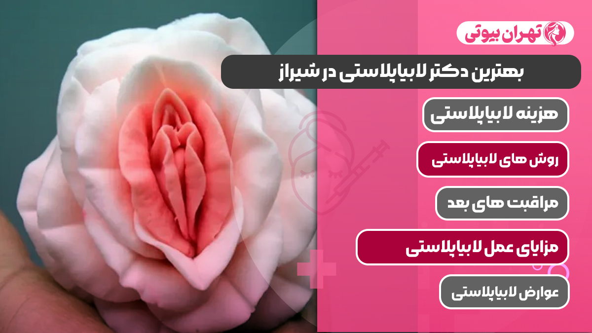 10 بهترین دکتر لابیاپلاستی در شیراز