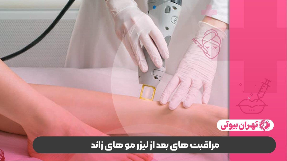 بهترین مرکز لیزر موهای زائد در غرب تهران