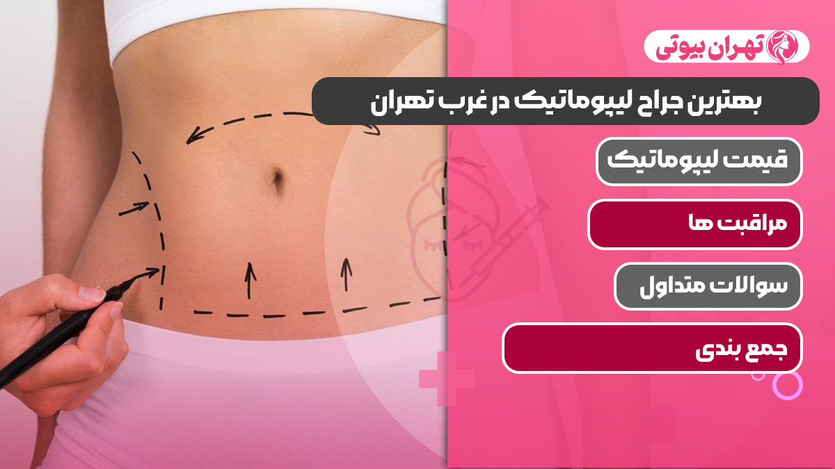 بهترین جراح لیپوماتیک در غرب تهران