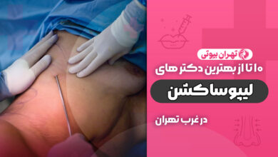 بهترین دکتر لیپوساکشن در غرب تهران