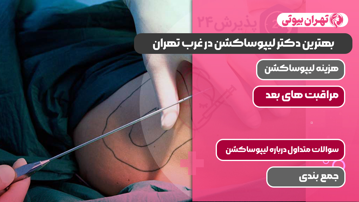 بهترین دکتر لیپوساکشن در غرب تهران