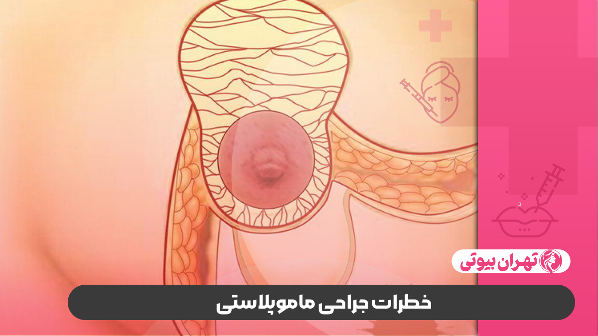 بهترین جراح ماموپلاستی در غرب تهران