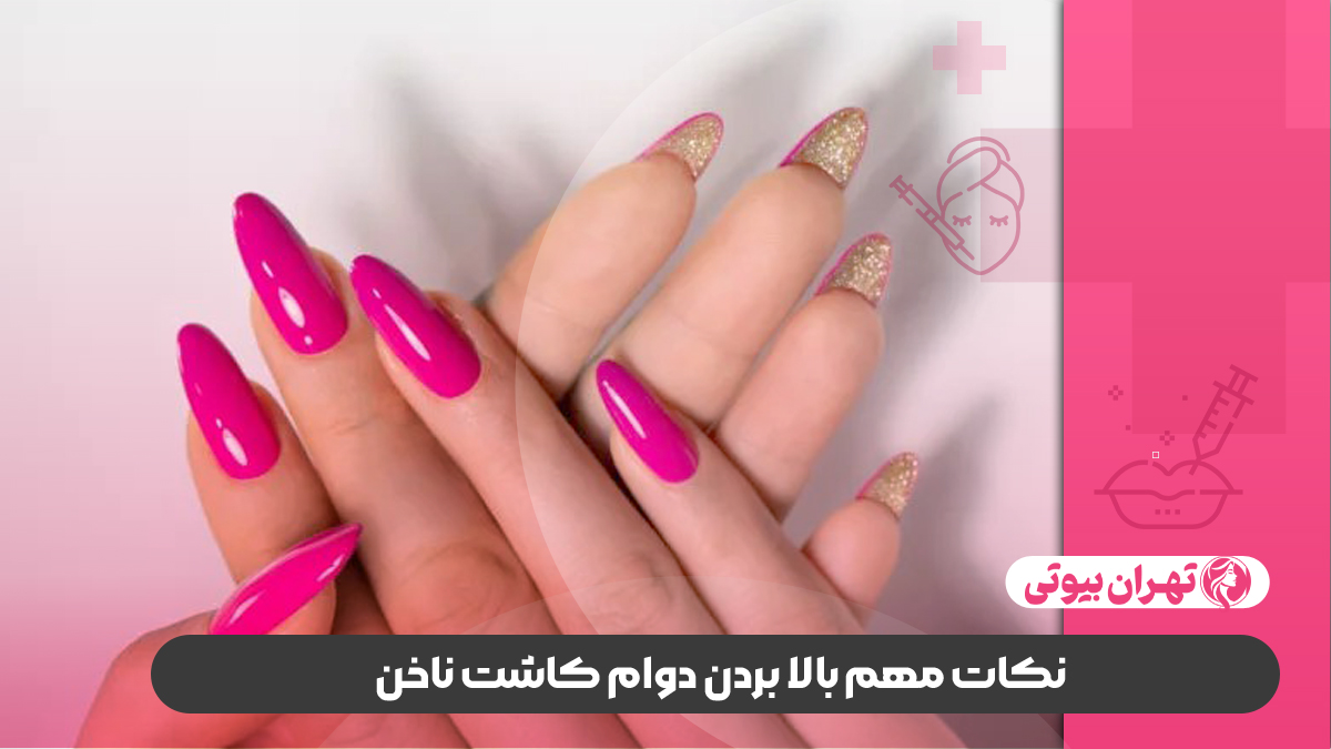 بهترین سالن کاشت ناخن در غرب تهران