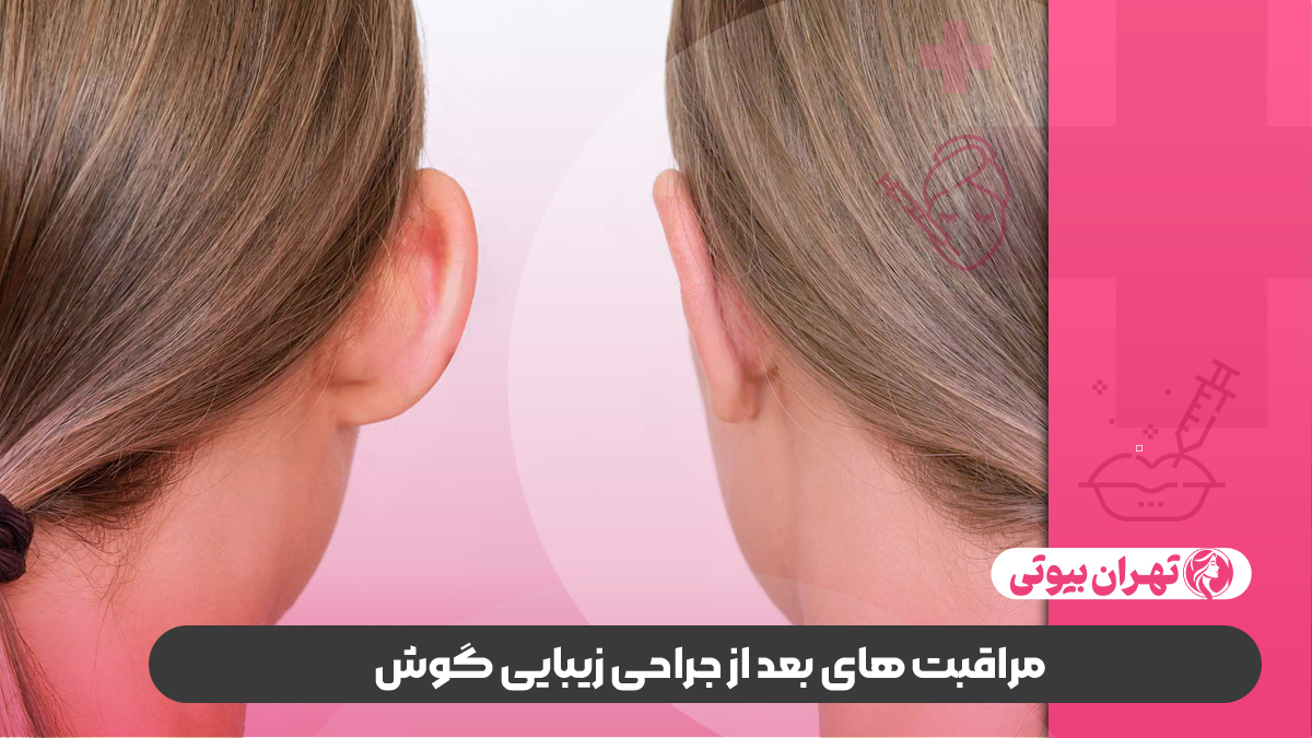 بهترین جراح اتوپلاستی در غرب تهران