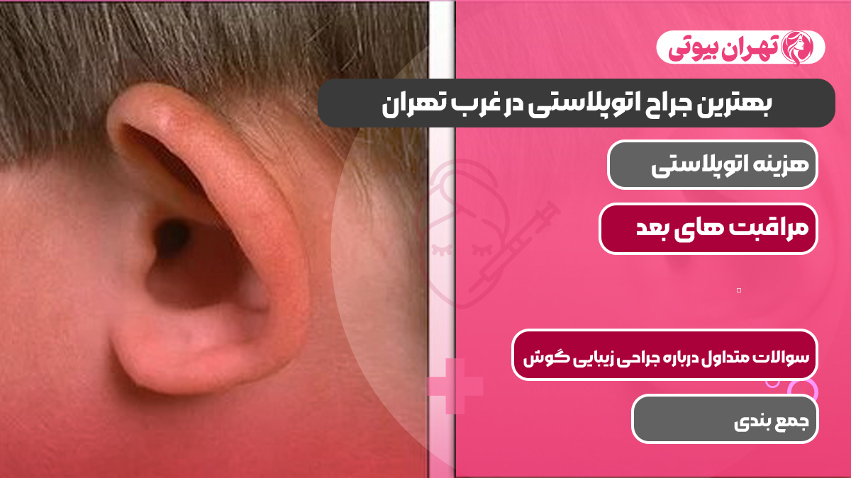بهترین جراح اتوپلاستی در غرب تهران