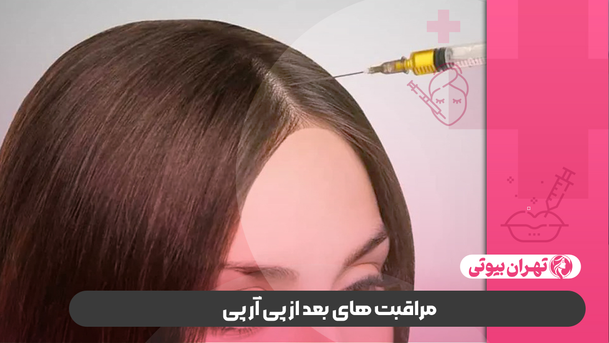 بهترین مرکز پی آر پی مو در غرب تهران