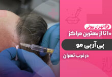بهترین مرکز پی آر پی مو در غرب تهران