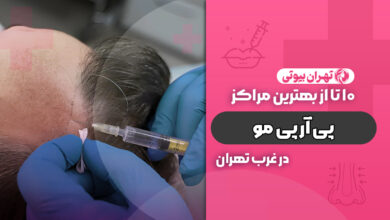 بهترین مرکز پی آر پی مو در غرب تهران