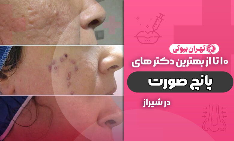 10 بهترین دکتر پانچ صورت در شیراز