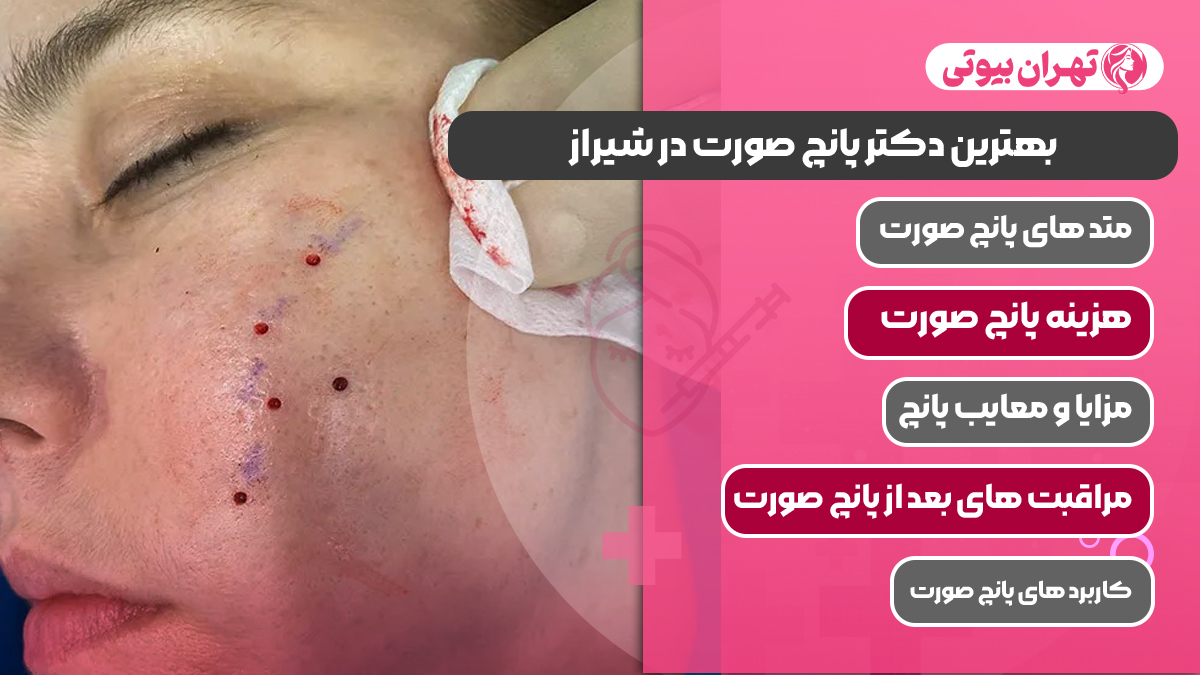 10 بهترین دکتر پانچ صورت در شیراز
