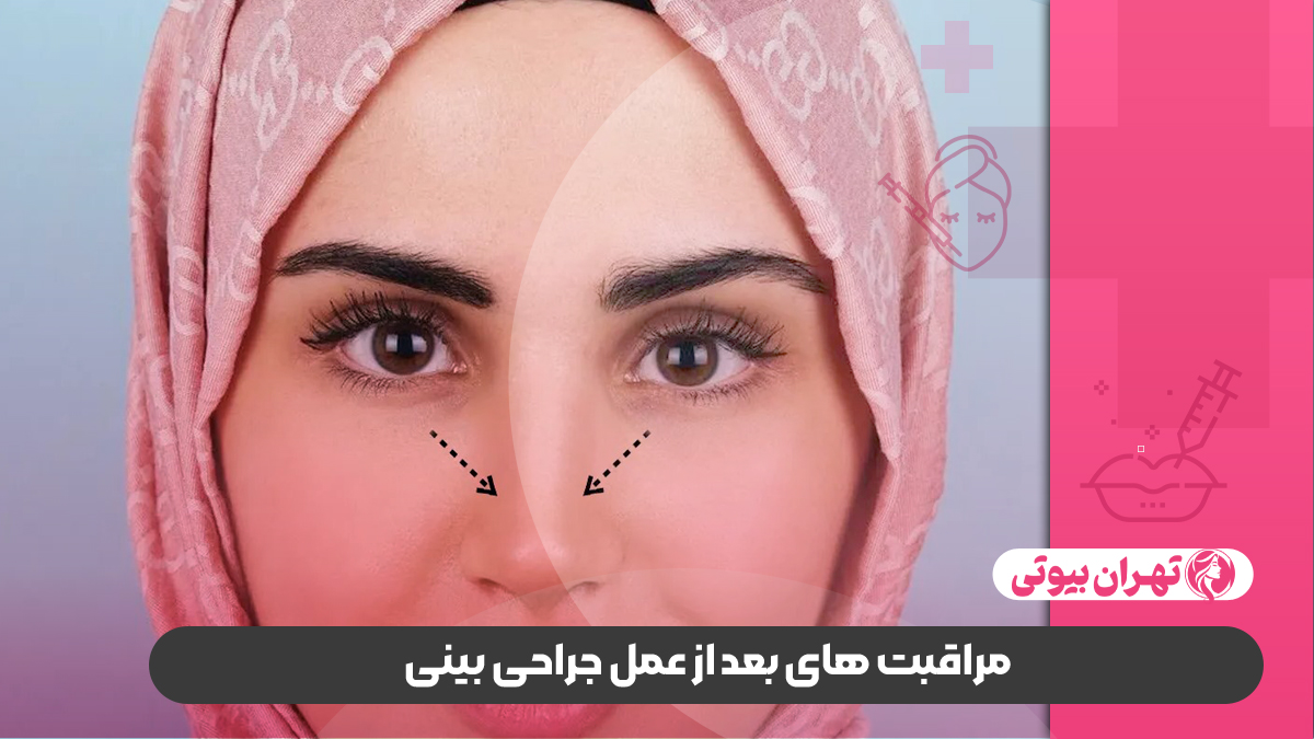 بهترین جراح بینی در غرب تهران