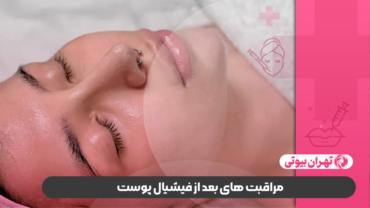 بهترین مرکز فیشیال در غرب تهران