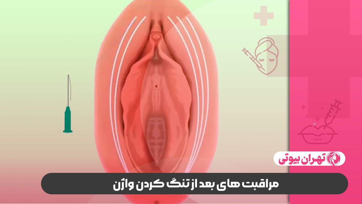بهترین دکتر تنگ کردن واژن ( واژینوپلاستی) در غرب تهران