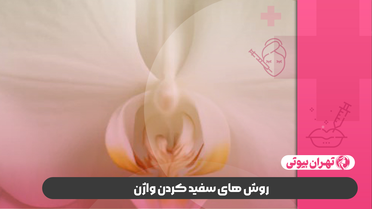 بهترین دکتر سفید کردن واژن در غرب تهران