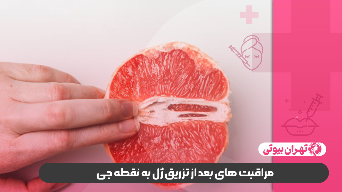10 بهترین دکتر تزریق ژل به نقطه جی در شیراز