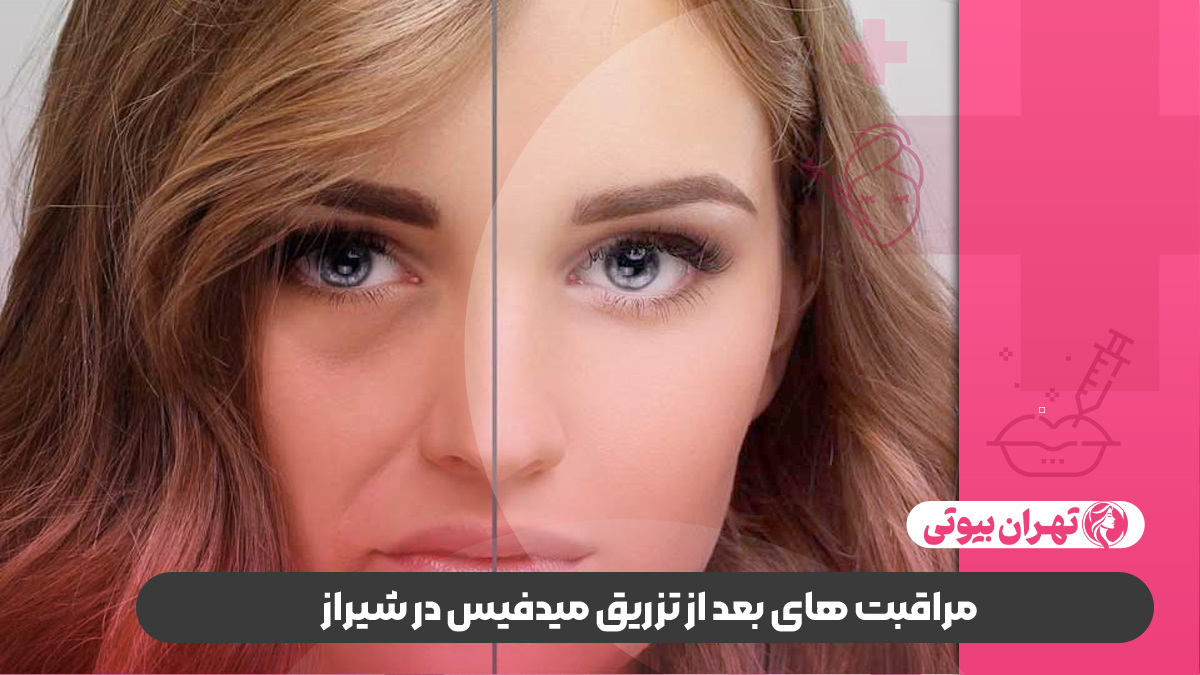 10 بهترین دکتر تزریق میدفیس در شیراز