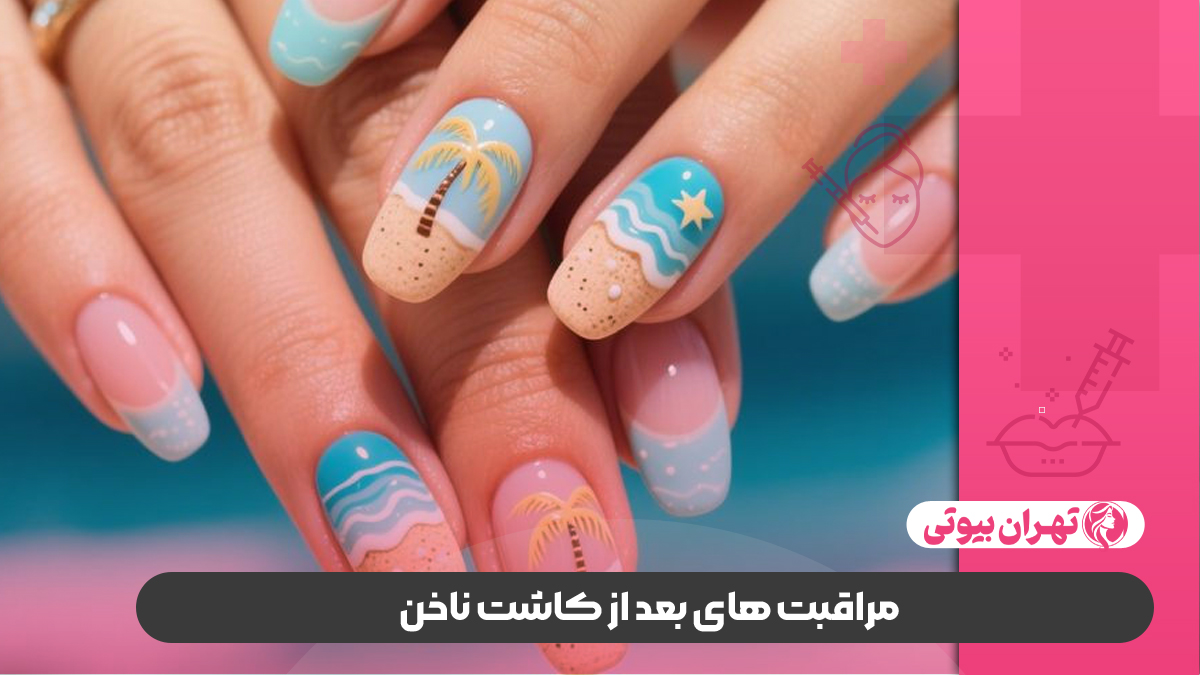 10 بهترین سالن کاشت ناخن در شیراز