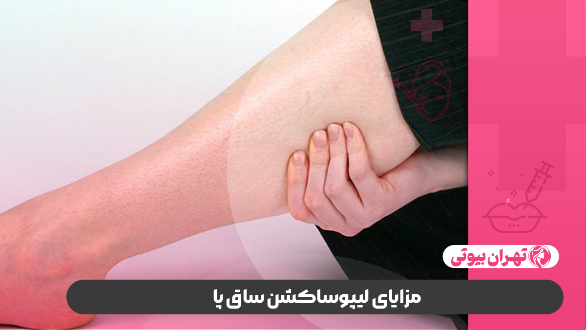 10 بهترین دکتر لیپوساکشن ساق پا در شیراز