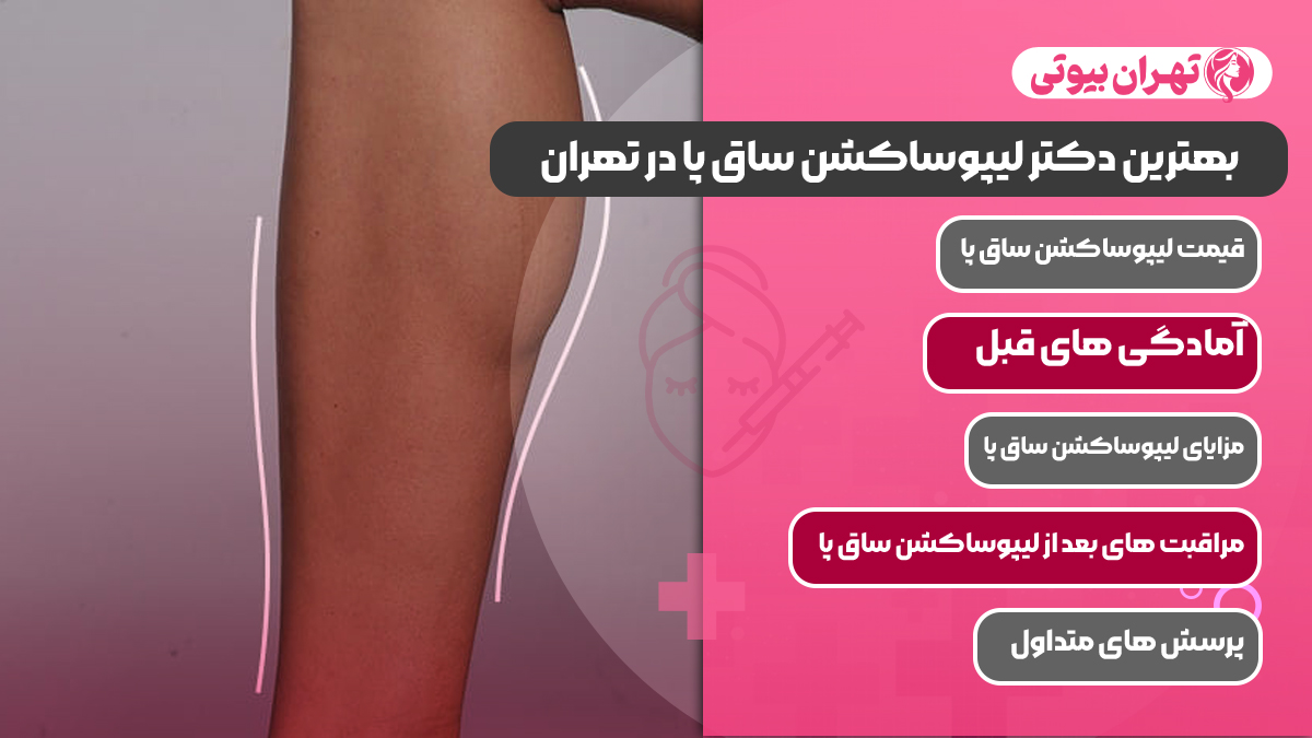 10 بهترین دکتر لیپوساکشن ساق پا در تهران