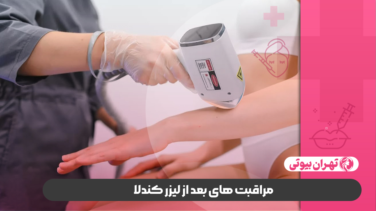 10 بهترین مرکز لیزر کندلا در شیراز