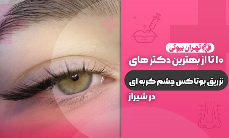 10 بهترین دکتر تزریق بوتاکس چشم گربه ای در شیراز