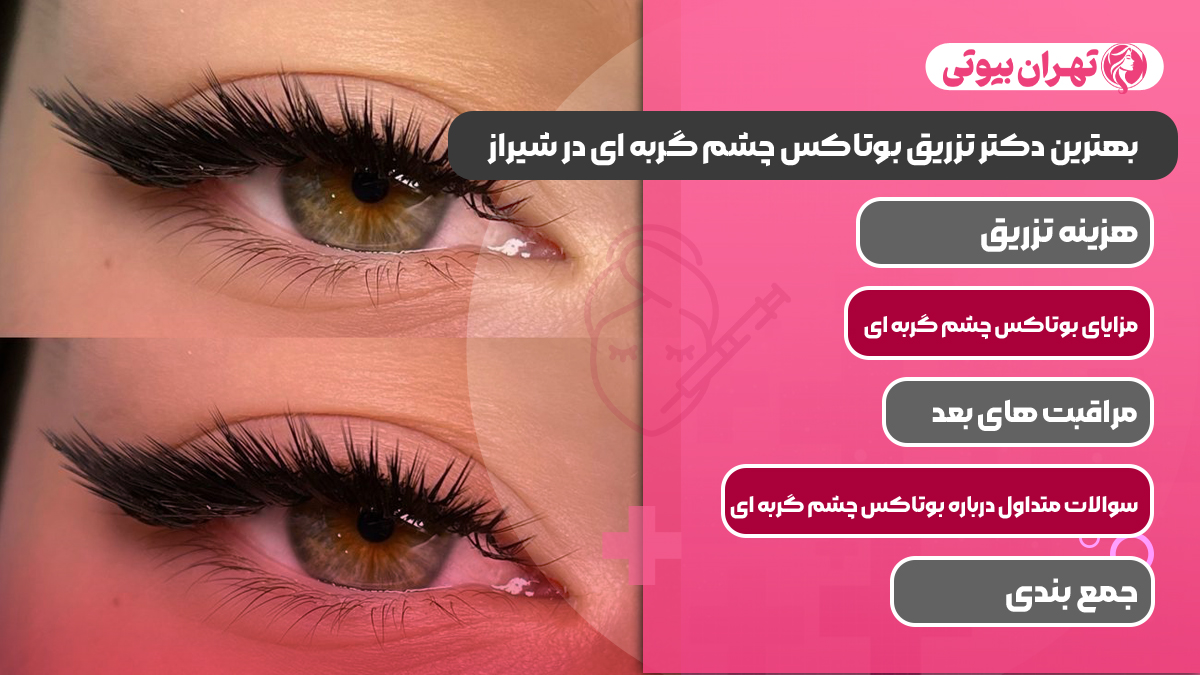 10 بهترین دکتر تزریق بوتاکس چشم گربه ای در شیراز