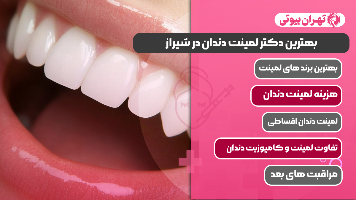 10 بهترین دکتر لمینت دندان در شیراز