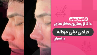 10 بهترین جراح بینی مردانه در تهران