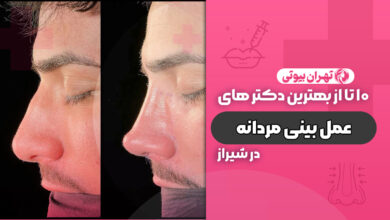 10 بهترین جراح بینی مردانه در شیراز