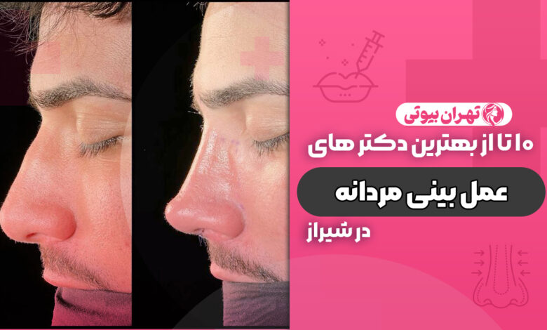 10 بهترین جراح بینی مردانه در شیراز