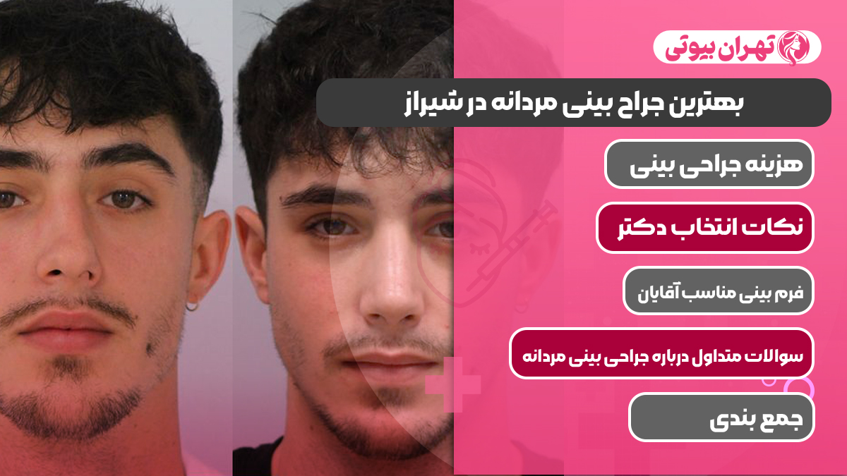 10 بهترین جراح بینی مردانه در شیراز