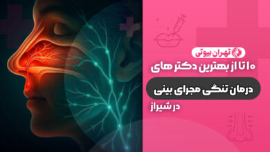 10 بهترین دکتر درمان تنگی مجرای بینی در شیراز