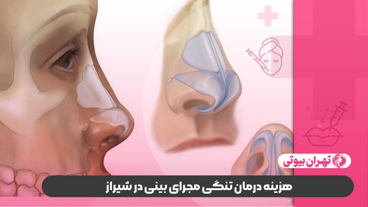 10 بهترین دکتر درمان تنگی مجرای بینی در شیراز