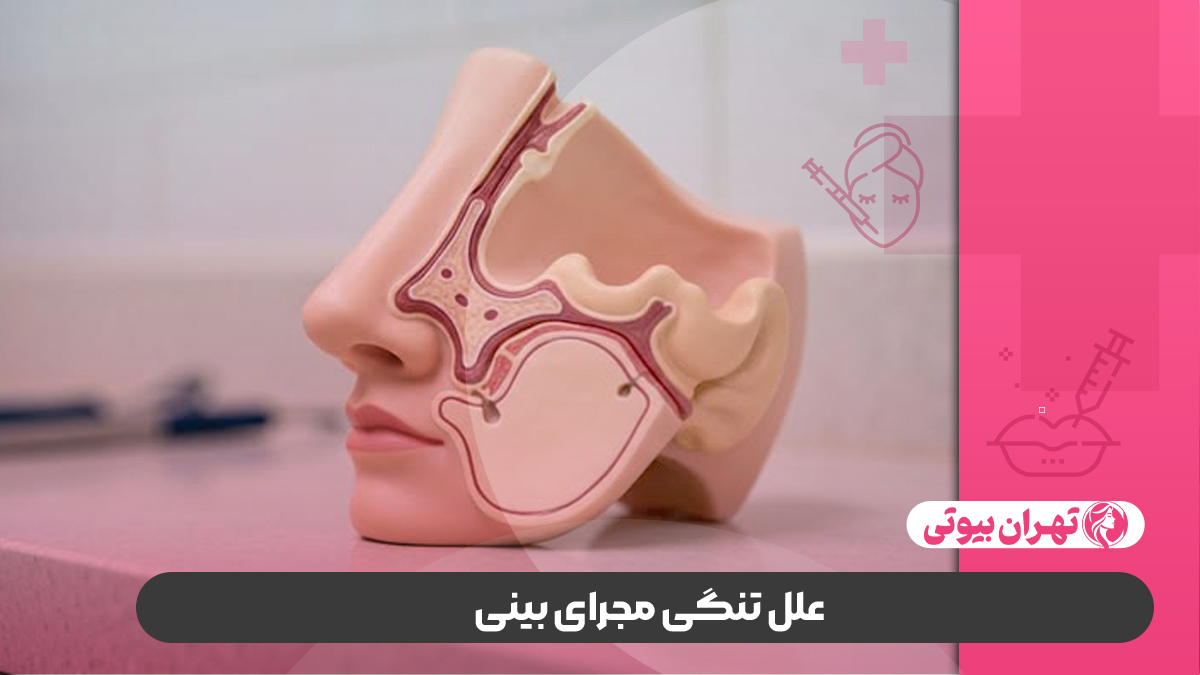 10 بهترین دکتر درمان تنگی مجرای بینی در تهران