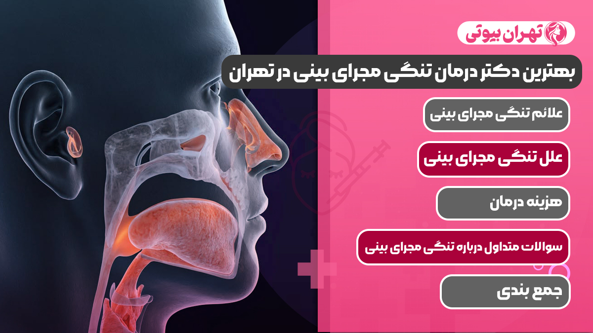 10 بهترین دکتر درمان تنگی مجرای بینی در تهران