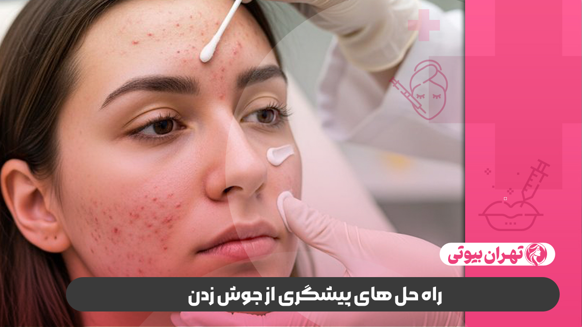 10 بهترین دکتر درمان جوش در شیراز
