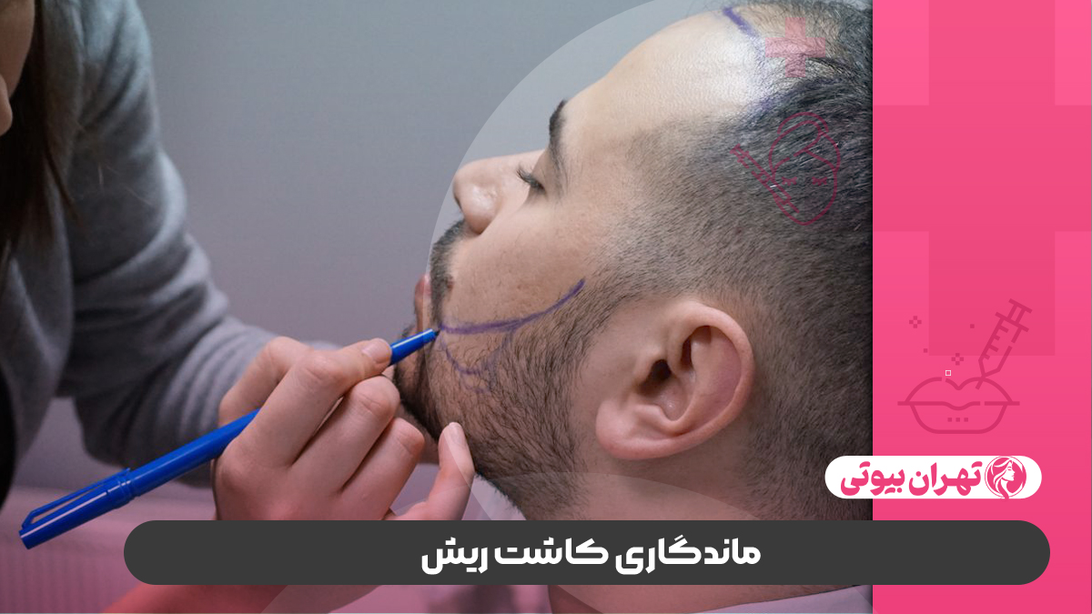 10 بهترین کلینیک کاشت ریش در شیراز