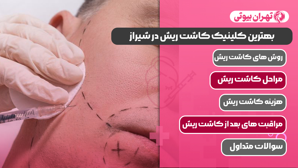10 بهترین کلینیک کاشت ریش در شیراز