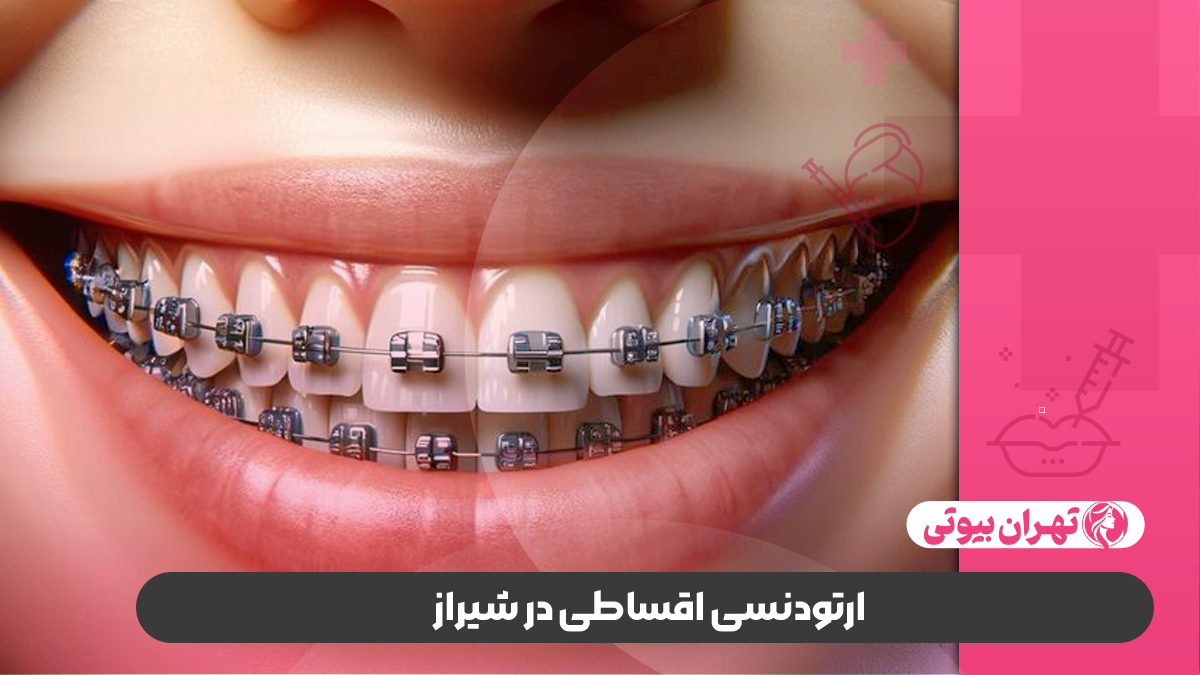 10 بهترین دکتر ارتودنسی در شیراز